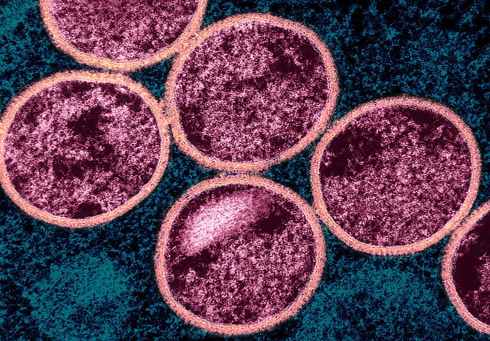 Expert expert reaction to reports of first reported Clade 1 mpox case in Ireland